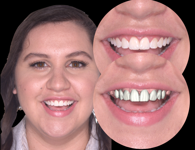 Patient-ready preview example